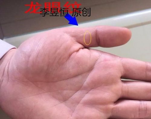 大拇指紋路透漏出怎樣的信息
