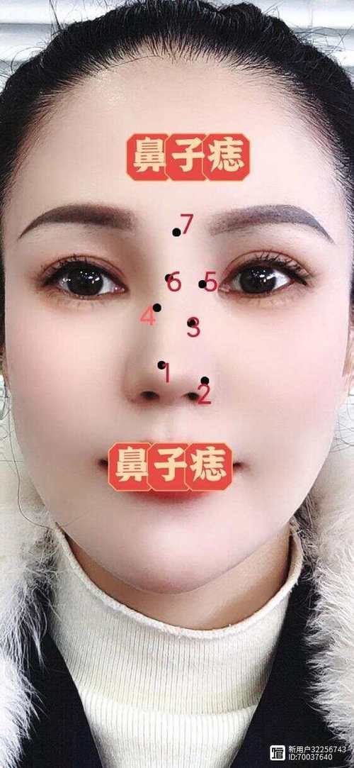 女生鼻子上的痣是美人痣嗎