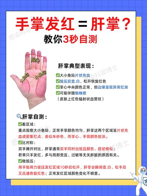 這三種手相的人，要注意身體健康了