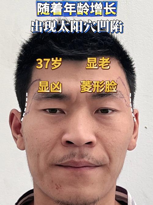 男人臉頰凹陷面相