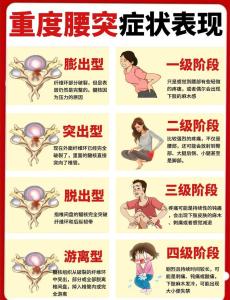 腰部特征推測你一生運勢