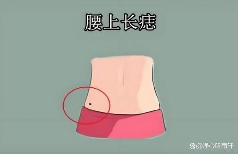 腰部痣是享福痣嗎