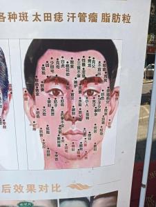 眼睛周圍的痣相是好是壞呢
