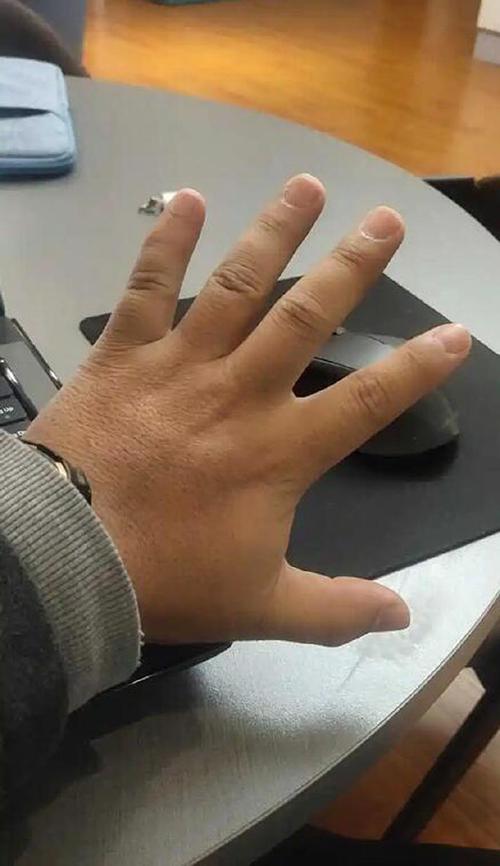 男人手掌厚實手指又短