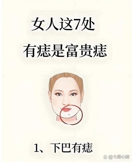 女人有一痣必嫁豪門是真的嗎
