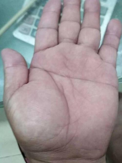 通貫掌有什么特征