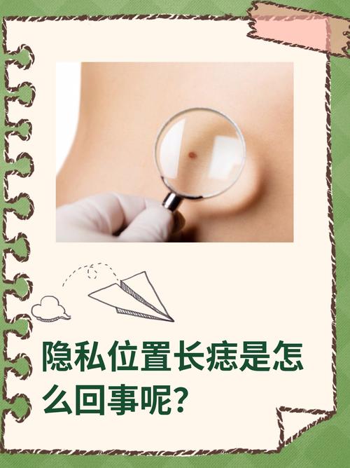 私密處有痣好嗎