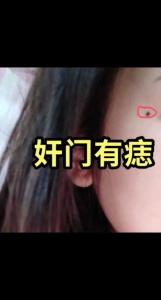 結(jié)婚后臉上突然長(zhǎng)痣 配偶可能有外遇