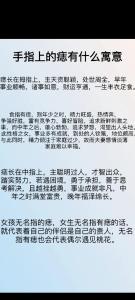 手指上有痣的人代表你身邊有貴人嗎