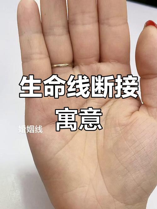 生命線斷開平行錯位又延伸 命長久嗎