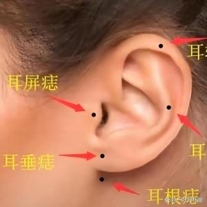 長(zhǎng)對(duì)稱痣好不好 耳窩對(duì)稱則財(cái)運(yùn)很好