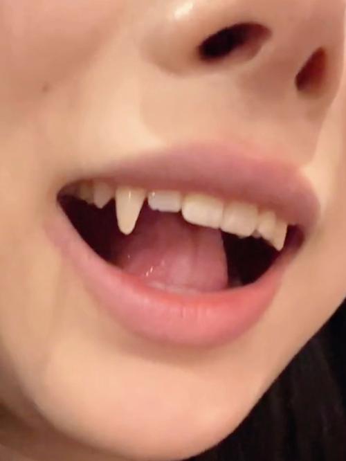 長虎牙好不好
