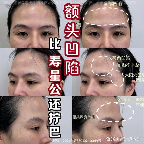 額頭凹陷的面相好嗎