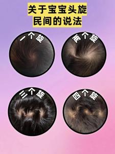 頭上三個旋命理說法