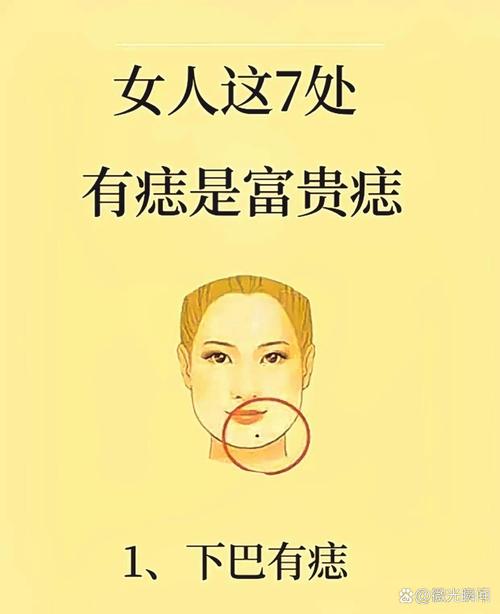 女生臉上痣為紅痣代表什么