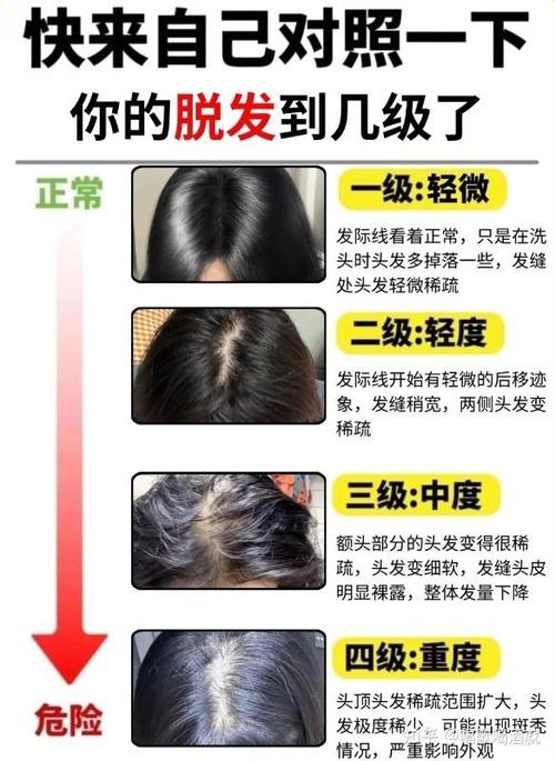 女人頭發(fā)稀少運勢解析