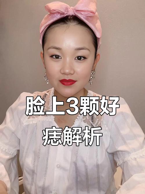 你有這三顆極其幸運的痣嗎