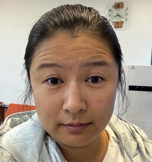 抬頭紋重的女人命苦 總是多愁善感
