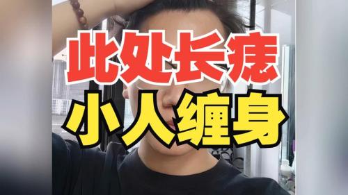 這幾處痣會(huì)讓你小人纏身，是非滿天！