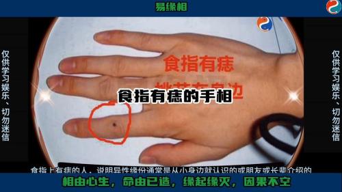 右手食指有痣的人有富貴命嗎