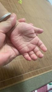 看掌紋知寶寶的身體狀況