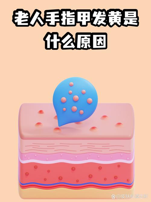 指甲顏色的變化預(yù)示著什么