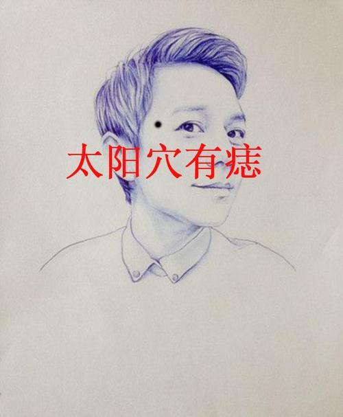 男人太陽(yáng)穴有痣