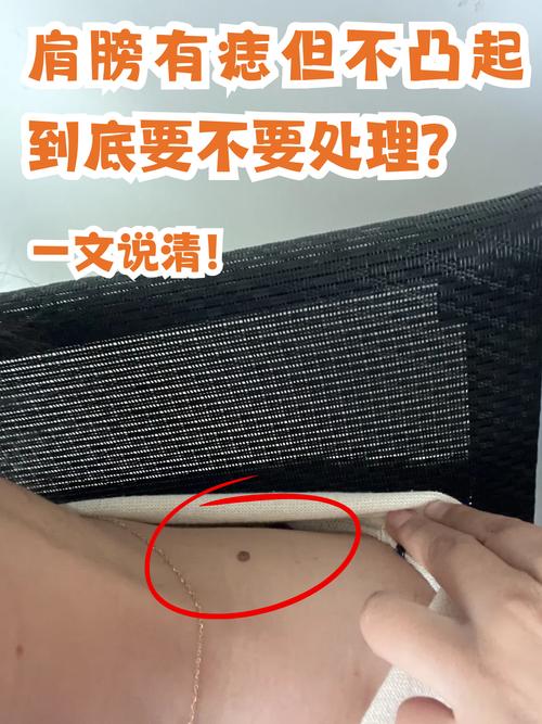 左肩膀有痣的男人