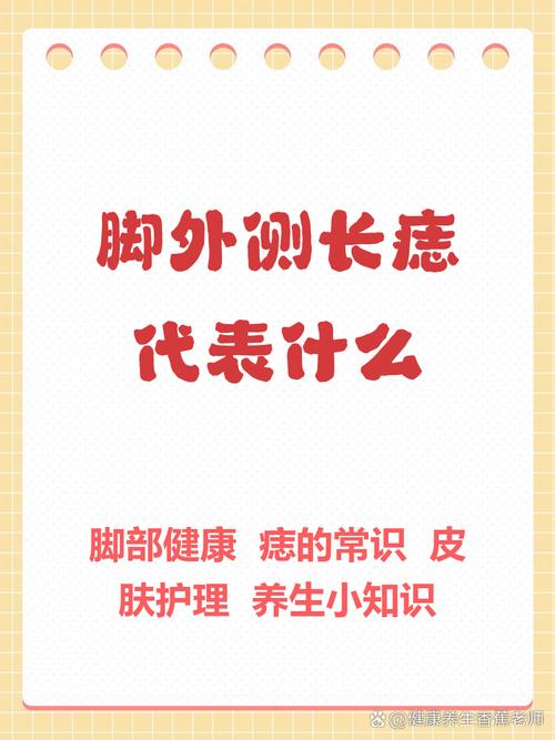 腳外側(cè)長(zhǎng)痣代表什么