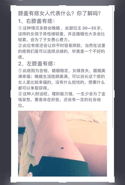 女子膝蓋上有痣代表什么呢′