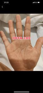 有元寶紋的男人會有貴人相助嗎