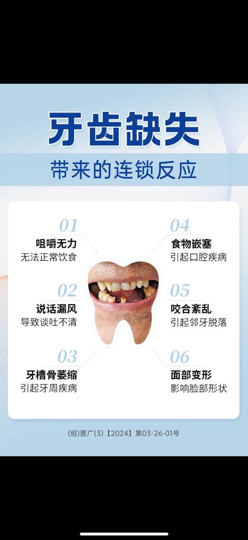 牙齒稀疏的人命運好不好 有什么說法