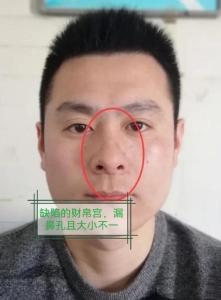 沒鼻梁的男人財運