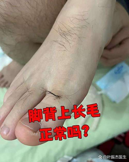 男人腳背上長毛的都是什么命