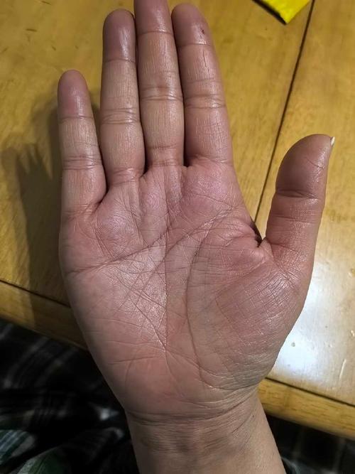 異常有福氣人的手的特征