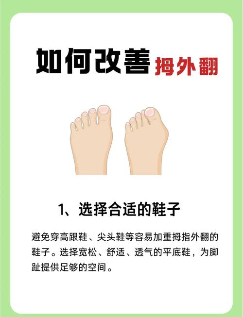 腳趾外翻的女人命