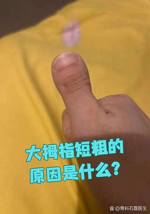 大拇指粗短人的命