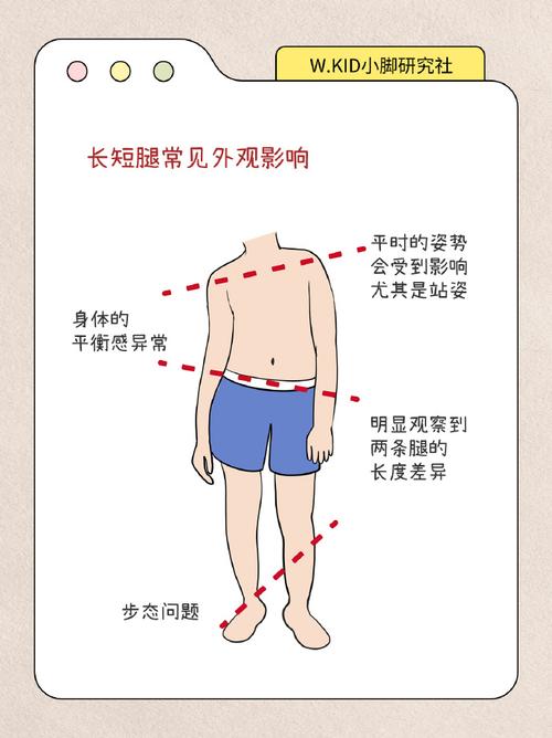 從四肢看相