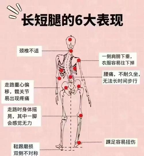 腿短說明什么