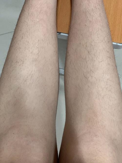 女人腿毛多有沒有福氣 長腿毛的女人命好嗎