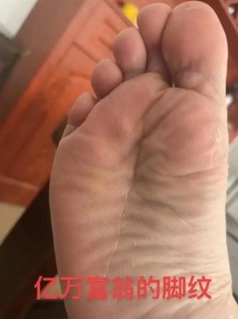 腳底板擁有這些紋路的人多半是人中龍鳳