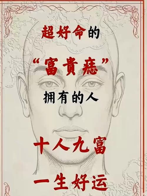 有這種痣相人，擁有富翁命