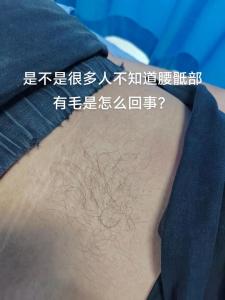 身體這些地方長毛有福氣