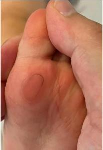 腳底有毛的女人不能要