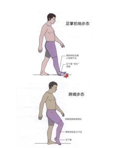 體相學(xué)中什么樣的腿型感情容易受挫折