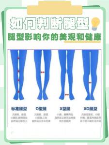 從一個(gè)人的腿型能預(yù)知健康情況嗎