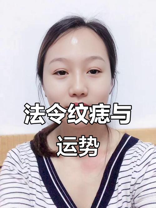 女人法令紋附近有痣