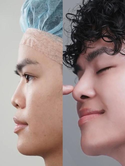 男人塌鼻子好不好 代表什么