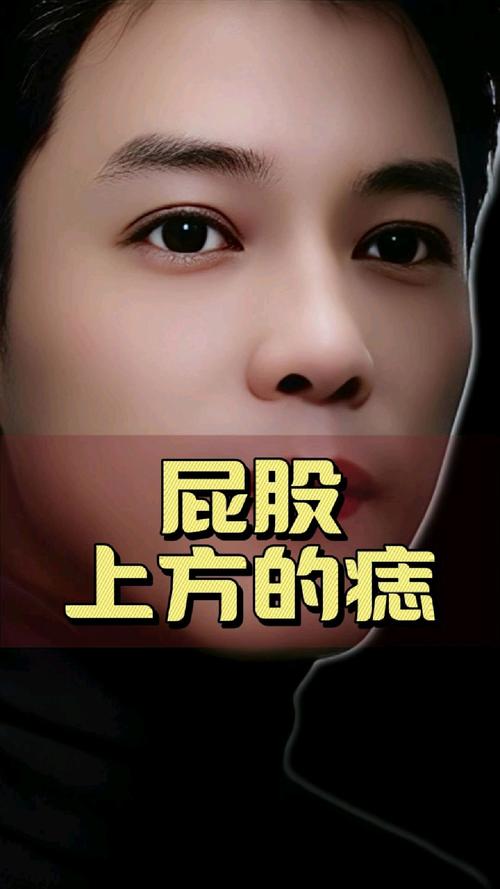女生屁股上有痣