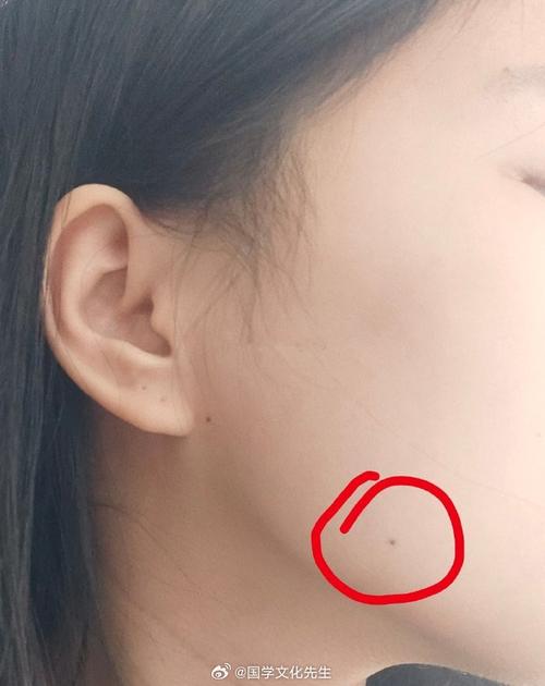 女右鰓有痣